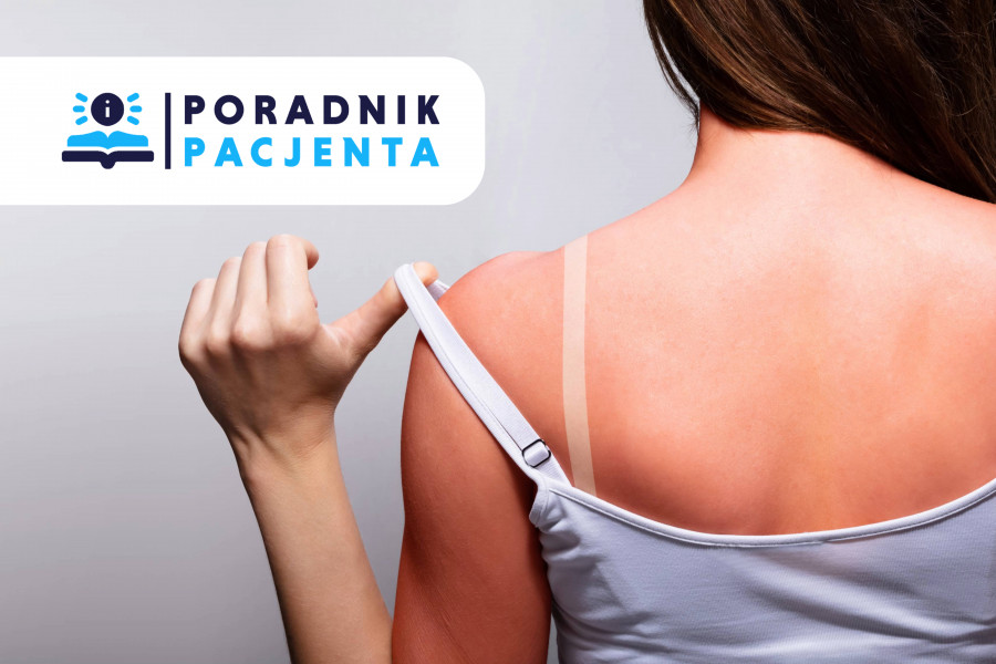 Poradnik Pacjenta: Słońce, a nasza skóra. Jak uniknąć oparzeń słonecznych?